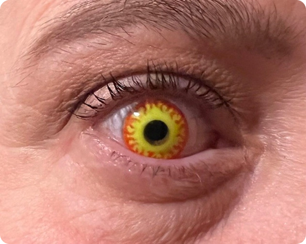 Close-up of an eye with a contact lens featuring a yellow background and red flame-like designs around the pupil.