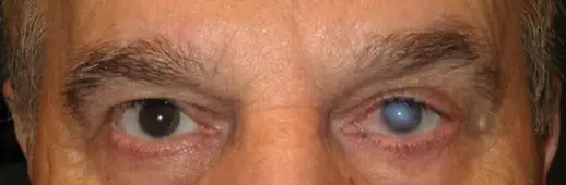 A close up of the eyes and nose of a person